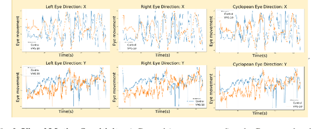 Figure 3 for Virtual-Reality based Vestibular Ocular Motor Screening for Concussion Detection using Machine-Learning