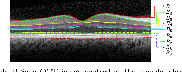 Figure 4 for OCT segmentation: Integrating open parametric contour model of the retinal layers and shape constraint to the Mumford-Shah functional