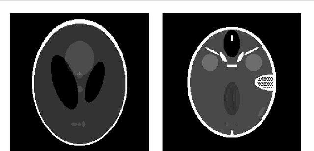 Figure 3 for Limited-angle CT reconstruction via the L1/L2 minimization
