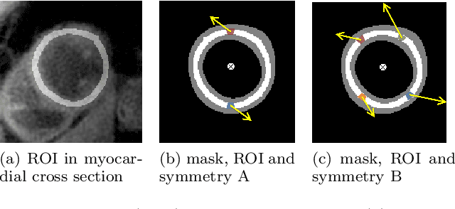 Figure 1 for Translational Motion Compensation for Soft Tissue Velocity Images