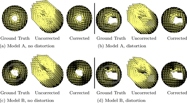 Figure 3 for Translational Motion Compensation for Soft Tissue Velocity Images