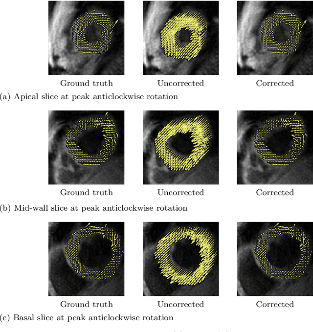 Figure 4 for Translational Motion Compensation for Soft Tissue Velocity Images