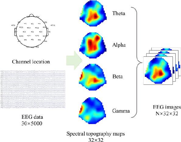 Figure 1 for An EEG-based approach for Parkinson's disease diagnosis using Capsule network