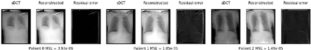 Figure 2 for Fluid registration between lung CT and stationary chest tomosynthesis images