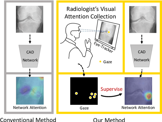 Figure 1 for Follow My Eye: Using Gaze to Supervise Computer-Aided Diagnosis