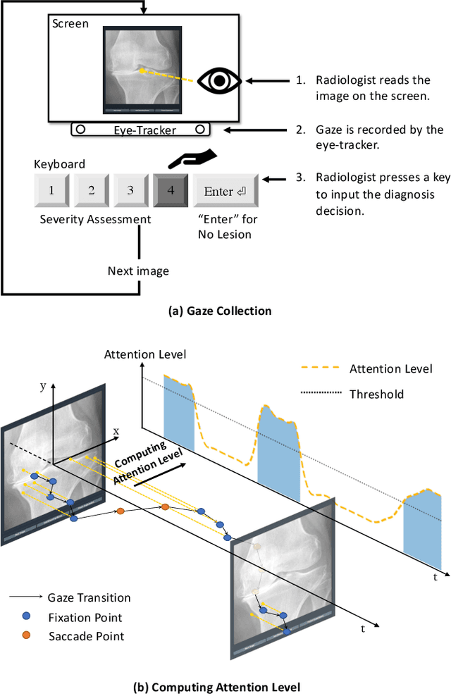 Figure 2 for Follow My Eye: Using Gaze to Supervise Computer-Aided Diagnosis