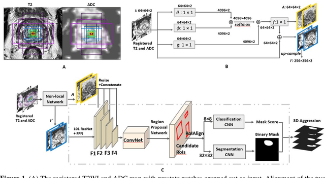 Figure 2 for Accurate Prostate Cancer Detection and Segmentation on Biparametric MRI using Non-local Mask R-CNN with Histopathological Ground Truth