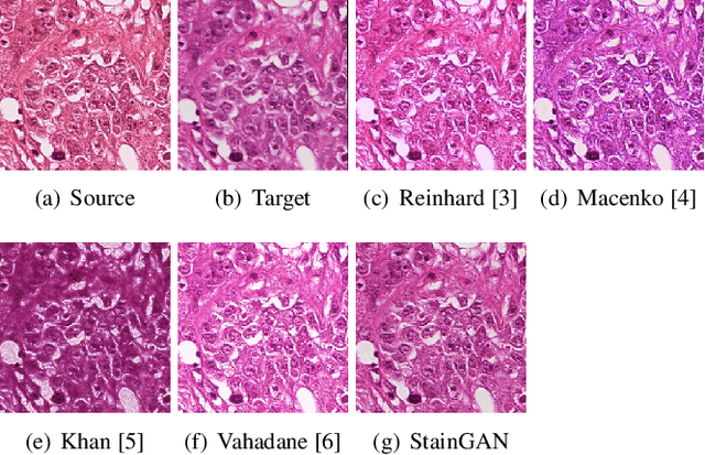 Figure 1 for StainGAN: Stain Style Transfer for Digital Histological Images