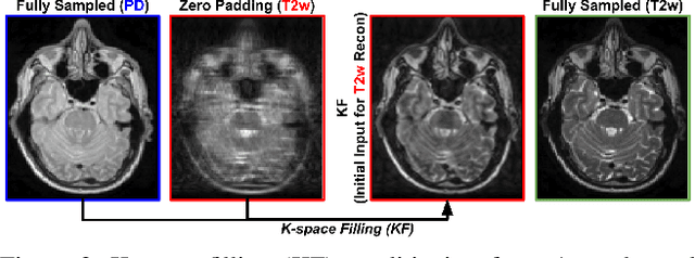 Figure 3 for DSFormer: A Dual-domain Self-supervised Transformer for Accelerated Multi-contrast MRI Reconstruction