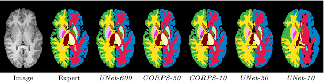 Figure 4 for CORPS: Cost-free Rigorous Pseudo-labeling based on Similarity-ranking for Brain MRI Segmentation