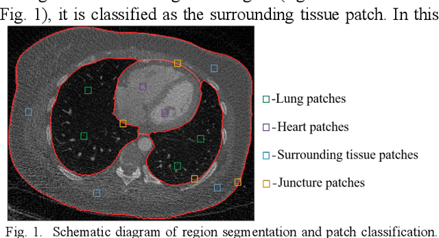 Figure 1 for Region-specific Dictionary Learning-based Low-dose Thoracic CT Reconstruction