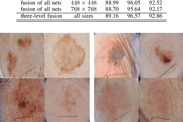 Figure 3 for Investigating and Exploiting Image Resolution for Transfer Learning-based Skin Lesion Classification