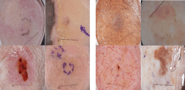 Figure 4 for Investigating and Exploiting Image Resolution for Transfer Learning-based Skin Lesion Classification
