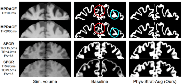 Figure 4 for Acquisition-invariant brain MRI segmentation with informative uncertainties