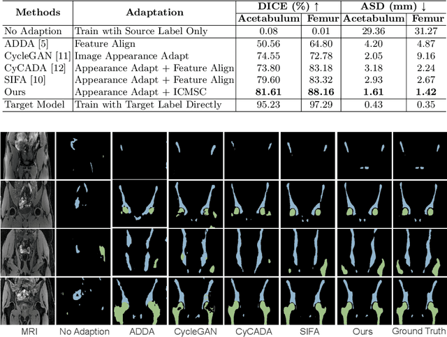 Figure 2 for ICMSC: Intra- and Cross-modality Semantic Consistency for Unsupervised Domain Adaptation on Hip Joint Bone Segmentation