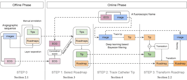 Figure 1 for Dynamic Coronary Roadmapping via Catheter Tip Tracking in X-ray Fluoroscopy with Deep Learning Based Bayesian Filtering
