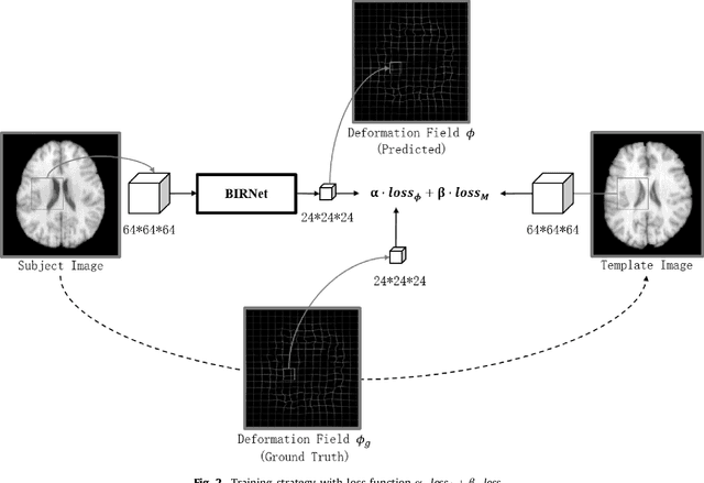 Figure 3 for BIRNet: Brain Image Registration Using Dual-Supervised Fully Convolutional Networks