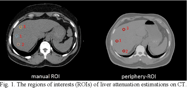 Figure 1 for Fully Automatic Liver Attenuation Estimation Combing CNN Segmentation and Morphological Operations