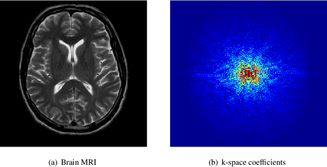 Figure 1 for A Divide-and-Conquer Approach to Compressed Sensing MRI