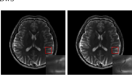 Figure 3 for A Divide-and-Conquer Approach to Compressed Sensing MRI