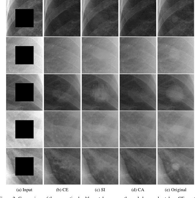 Figure 4 for Chest X-ray Inpainting with Deep Generative Models