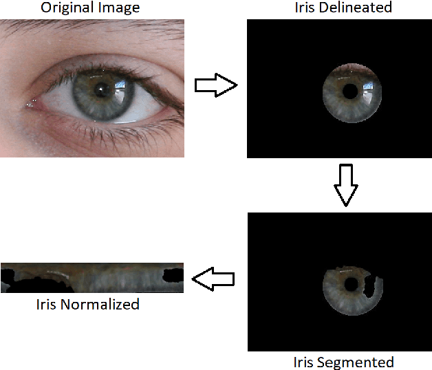 Figure 1 for The Impact of Preprocessing on Deep Representations for Iris Recognition on Unconstrained Environments