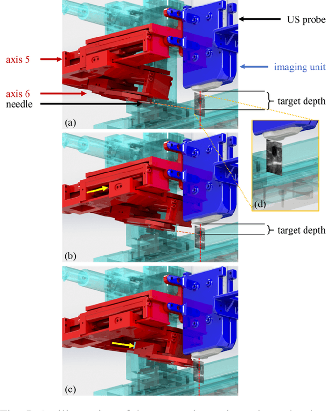 Figure 4 for VeniBot: Towards Autonomous Venipuncture with Semi-supervised Vein Segmentation from Ultrasound Images