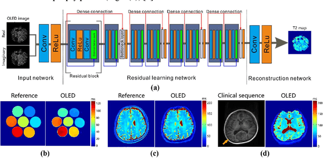 Figure 4 for Physics-driven Synthetic Data Learning for Biomedical Magnetic Resonance