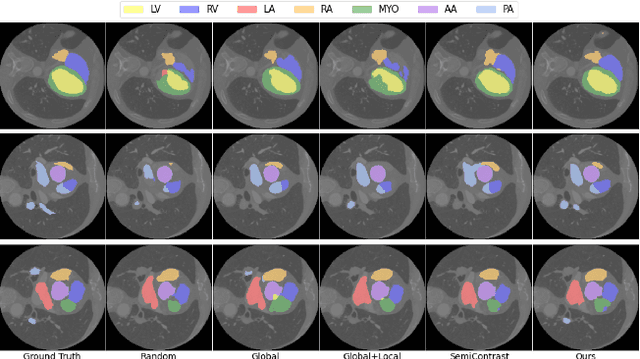 Figure 2 for MMGL: Multi-Scale Multi-View Global-Local Contrastive learning for Semi-supervised Cardiac Image Segmentation