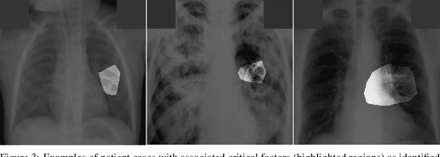 Figure 3 for TB-Net: A Tailored, Self-Attention Deep Convolutional Neural Network Design for Detection of Tuberculosis Cases from Chest X-ray Images