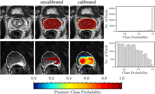 Figure 1 for Confidence Calibration and Predictive Uncertainty Estimation for Deep Medical Image Segmentation