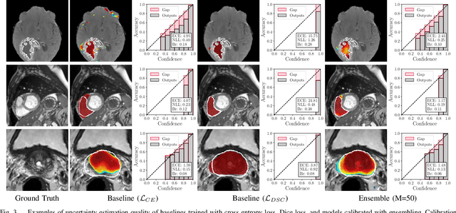 Figure 3 for Confidence Calibration and Predictive Uncertainty Estimation for Deep Medical Image Segmentation
