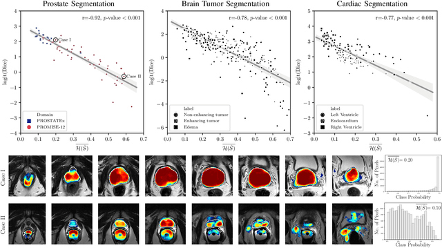 Figure 4 for Confidence Calibration and Predictive Uncertainty Estimation for Deep Medical Image Segmentation