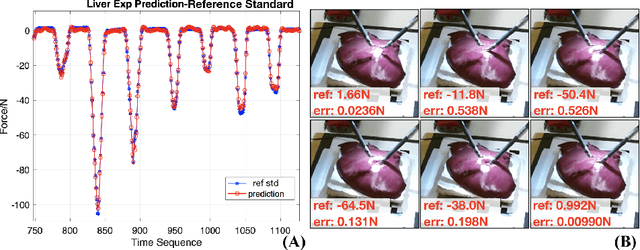 Figure 1 for Learning to See Forces: Surgical Force Prediction with RGB-Point Cloud Temporal Convolutional Networks