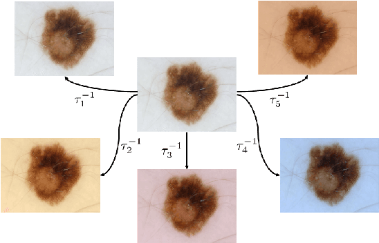 Figure 3 for Data-Driven Color Augmentation Techniques for Deep Skin Image Analysis