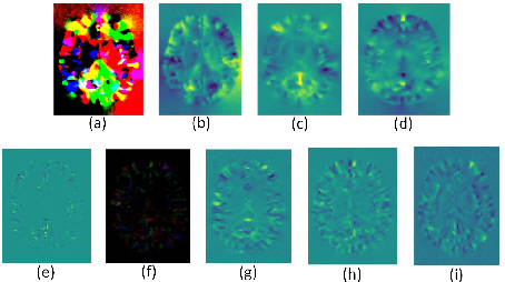Figure 4 for Deformable Registration Using Average Geometric Transformations for Brain MR Images