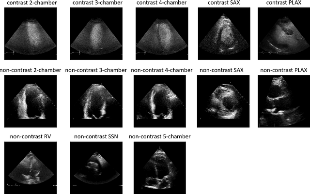 Figure 1 for Contrastive Learning for View Classification of Echocardiograms