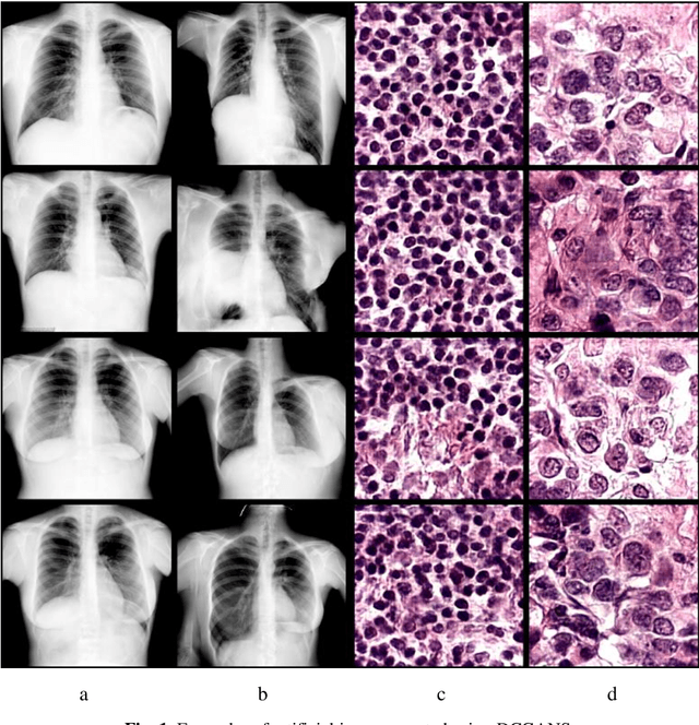 Figure 2 for Examining the Capability of GANs to Replace Real Biomedical Images in Classification Models Training