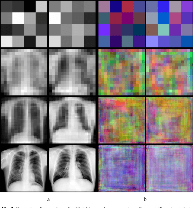Figure 4 for Examining the Capability of GANs to Replace Real Biomedical Images in Classification Models Training