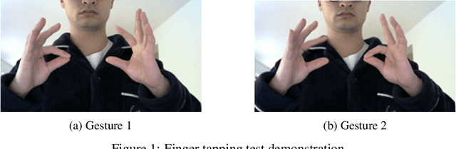 Figure 1 for Hand gesture detection in tests performed by older adults