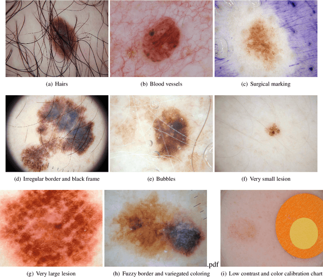 Figure 1 for A Survey on Deep Learning for Skin Lesion Segmentation