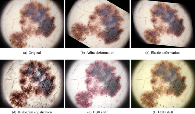 Figure 4 for A Survey on Deep Learning for Skin Lesion Segmentation
