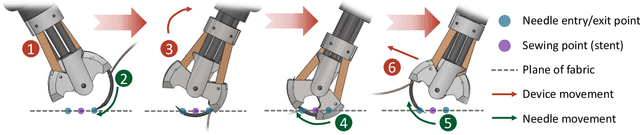 Figure 4 for Robotic Sewing and Knot Tying for Personalized Stent Graft Manufacturing