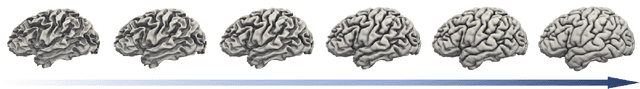 Figure 1 for CortexODE: Learning Cortical Surface Reconstruction by Neural ODEs