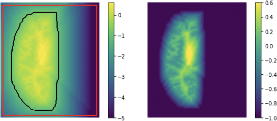 Figure 4 for CortexODE: Learning Cortical Surface Reconstruction by Neural ODEs