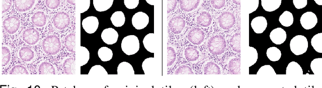 Figure 2 for SAFRON: Stitching Across the Frontier for Generating Colorectal Cancer Histology Images