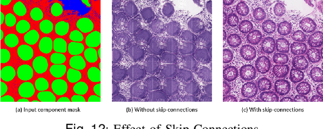 Figure 4 for SAFRON: Stitching Across the Frontier for Generating Colorectal Cancer Histology Images