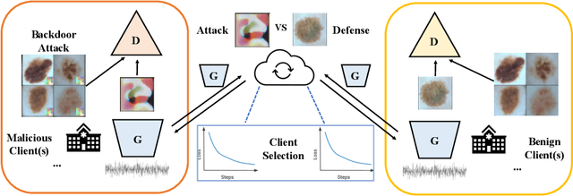 Figure 1 for Backdoor Attack is A Devil in Federated GAN-based Medical Image Synthesis