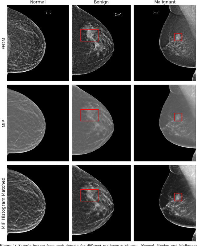 Figure 2 for Adaptation of a deep learning malignancy model from full-field digital mammography to digital breast tomosynthesis