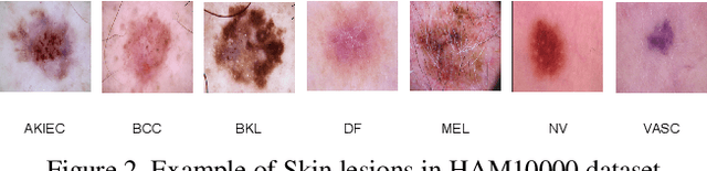 Figure 3 for Soft-Attention Improves Skin Cancer Classification Performance